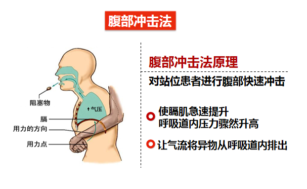 heimlich发明海姆立克腹部冲击法,现已成功挽救数十万生命,被人们称